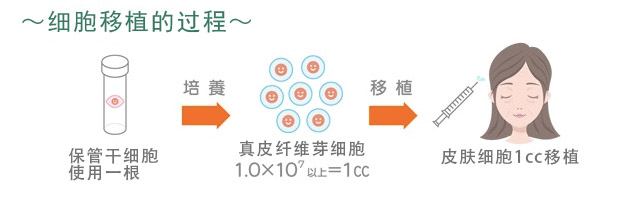 细胞移植的过程