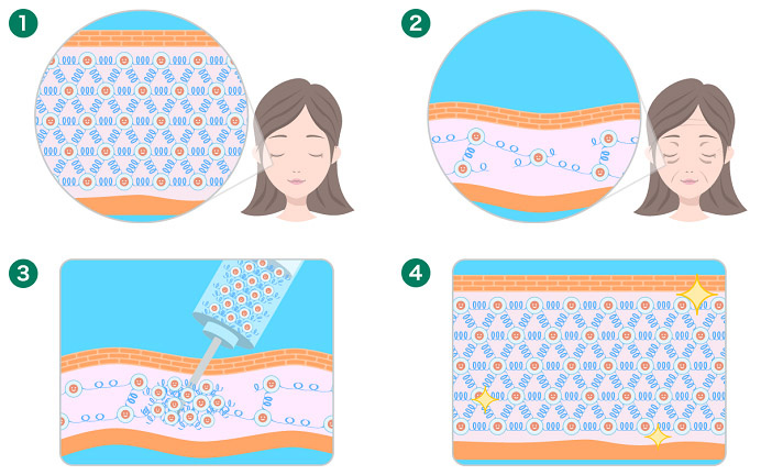 皮肤再生的详细构成