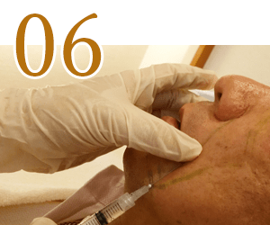 特别关注的地方部分注射