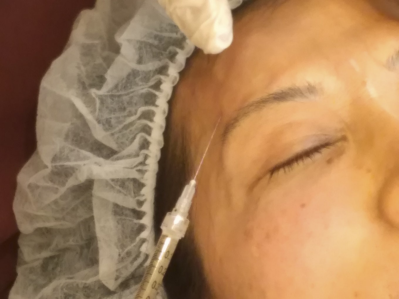 手动注射可以记减轻疼痛和缩短恢复时间