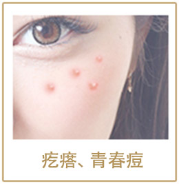 疙瘩、青春痘